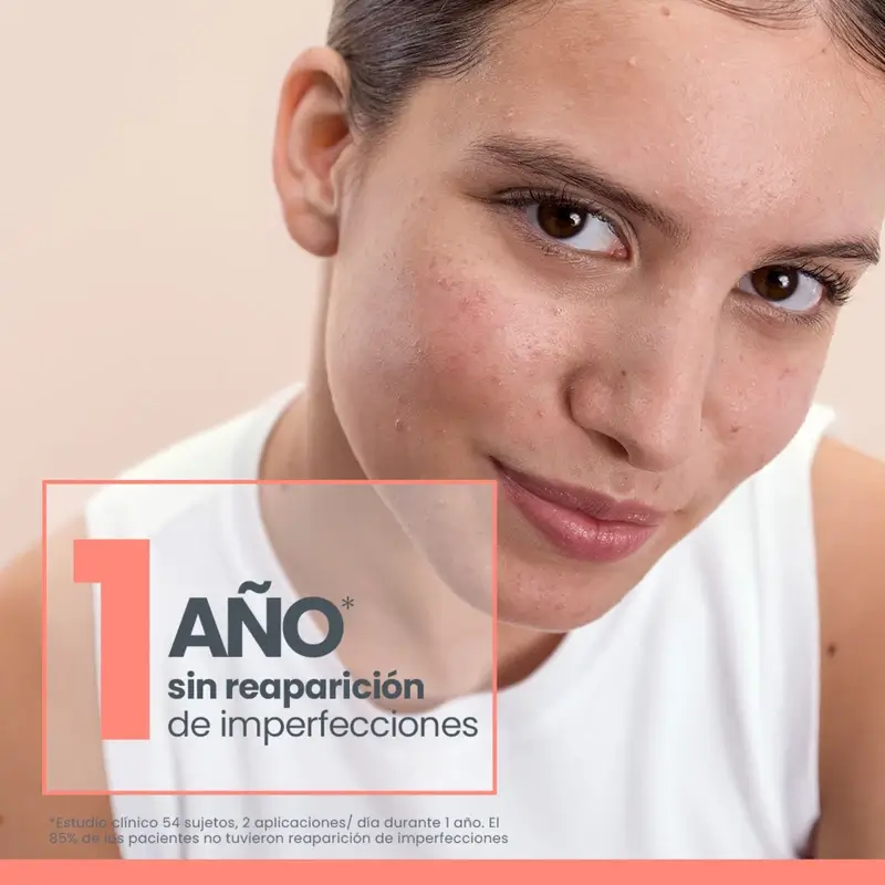 Avène Cleanance Comedomed Concentré Anti-Imperfection, 30 ml - Image 4