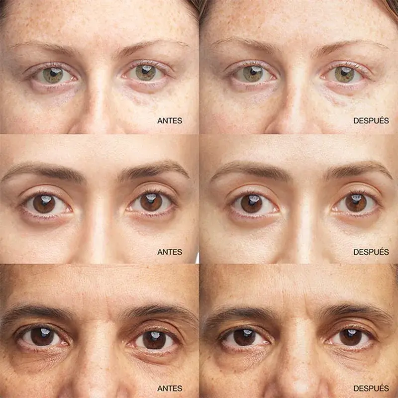 Clinique All About Eyes Illuminating Eye Serum Concentrate, 10 ml - Image 3